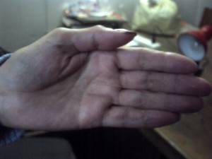 Figura 4